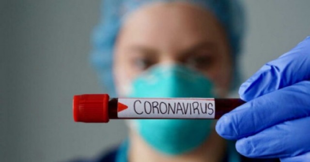 82 casos positivos de coronavirus